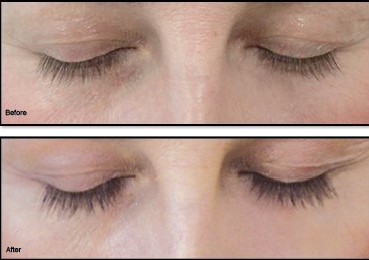 eyebrow & eyelash growth treatment tunbridge wells